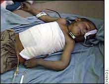 Afghan boy injured in the village of Agam