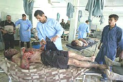 Wounded Iraqi soldiers