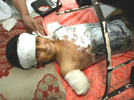12, who says he was wounded during an airstrike
