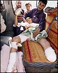 16 yr old, Assaduleh, one of the first civilians hit by a U.S. missile